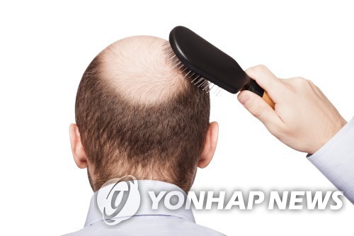 탈모