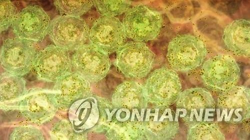 염증 신호를 받아 항체(갈색)를 형성하는 B세포(녹색)